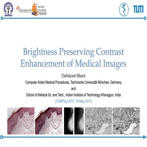 Brightness Preserving Contrast Enhancement Of Medical Images