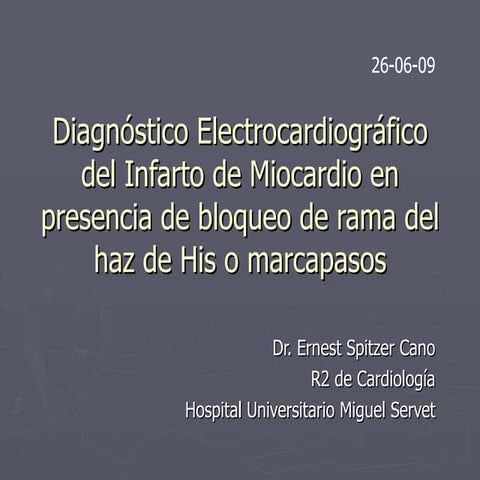 Diagnóstico Electrocardiográfico de Infarto de Miocardio en presencia de Bloq...