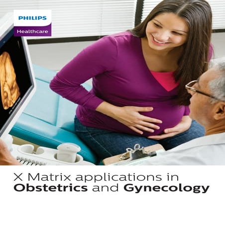 Brochure x matrix new | PDF