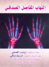 التهاب المفاصل الصدفي د زينب المصلي