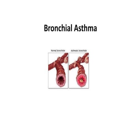 Bronchial-Asthma.pdf