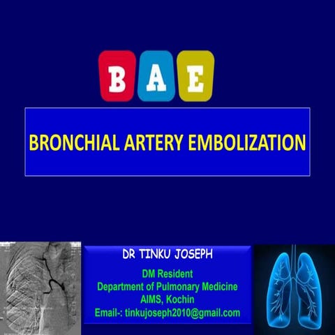 Bronchial Artery Embolization- By Dr.Tinku Joseph