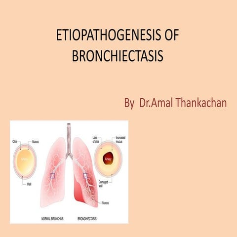 bronchiectasis Presentation1.pptx