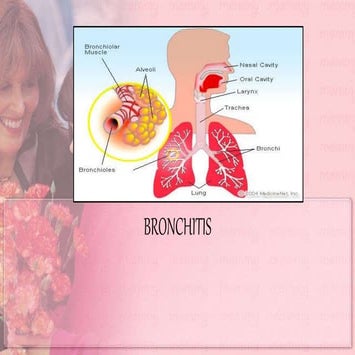 bronchitis - CHRONIC BRONCHITIS | PPTX