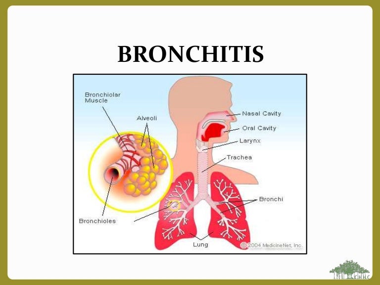 bronchitis presentation