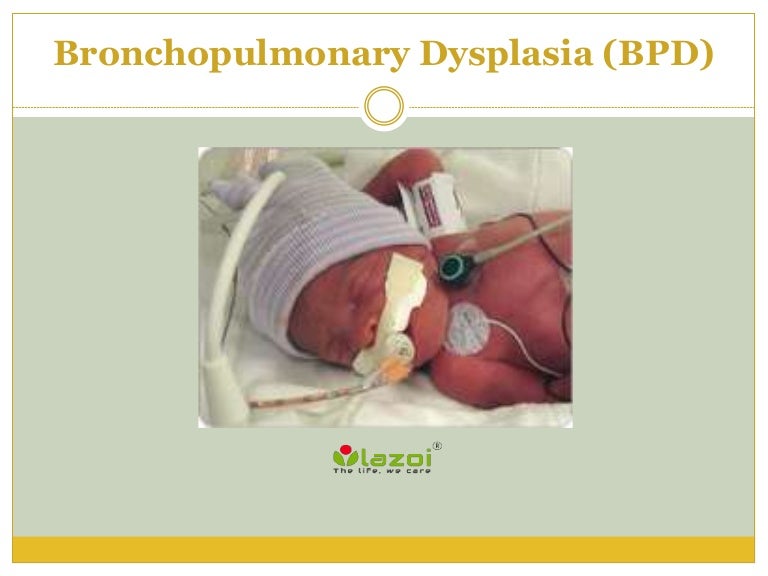 Bronchopulmonary Dysplasia Symptoms – DONVOJ