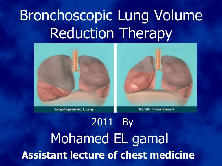 Bronchoscope lung volume reduction 2011