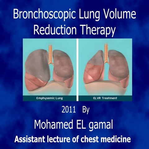 Bronchoscope lung volume reduction 2011