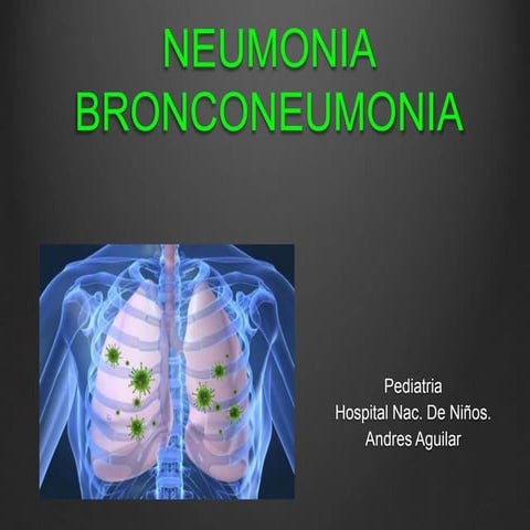 Bronconeumonia y neumonía  en Pxs pediatricos 