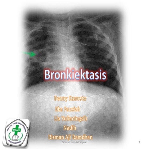 Bagaimana cara membaca foto rontgen/x-ray | PPT