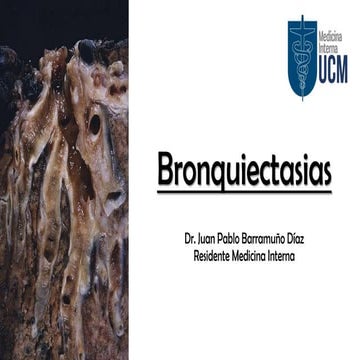 Bronquiectasias