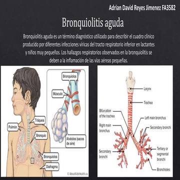 12. Bronquiolitis.pdf aguda y bronquilitis obliterante | PDF