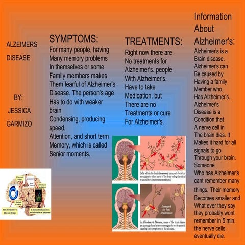 ALZEIMER'S jessica g.