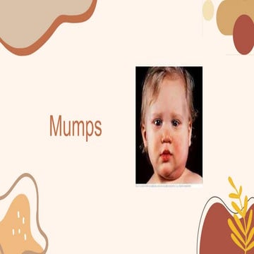 Mumps | PPTX