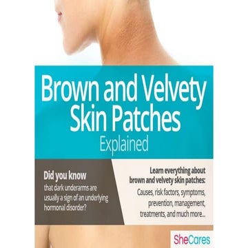 Brown and velvety skin patches infographics - SheCares | PPTX
