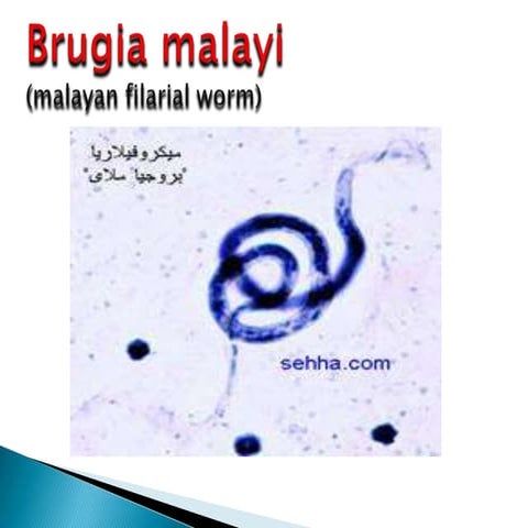 Brugia malayi
