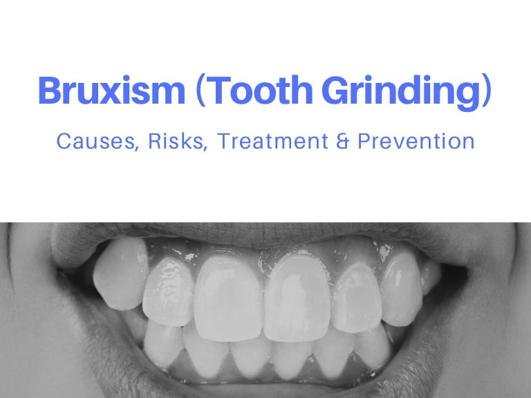 Bruxism Causes, Risks, Treatment, and Prevention