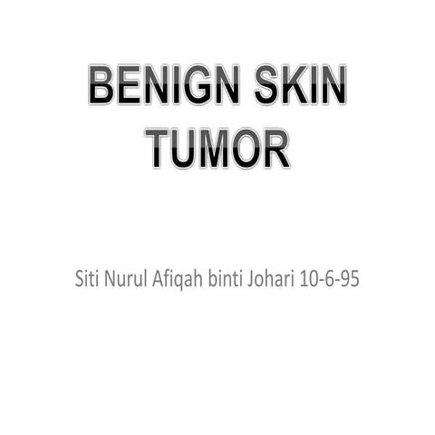 Benign Skin Tumor