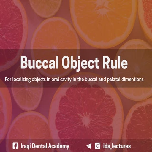 Buccal Object Rule A Radiographic Aid in Dental Practice. PPT
