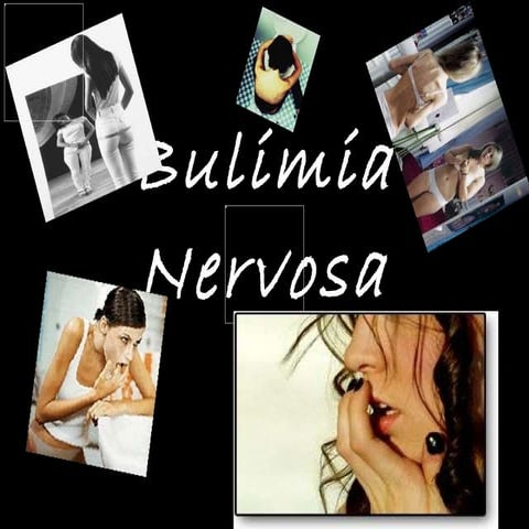 Bulimia nervosa