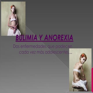 Bulimia y anorexia  power point