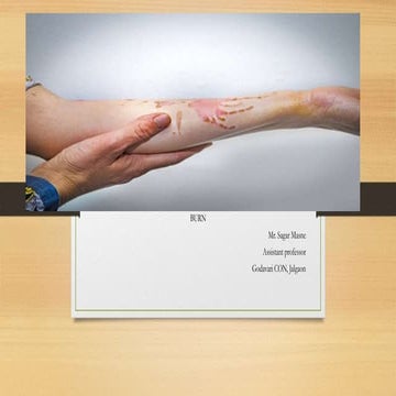 Burn & its Management for Nurses And Faculty of Nursing.pptx