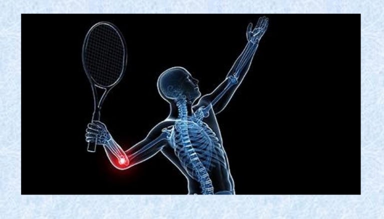 Burning pain in shoulder blade and elbow