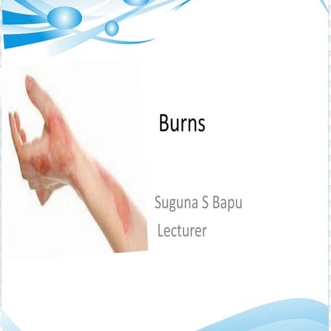 Burns