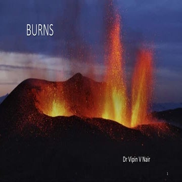 Burns