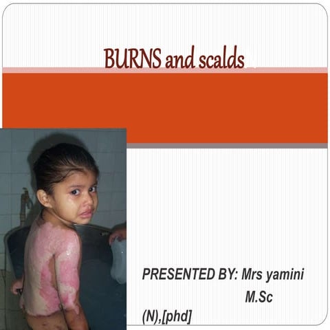 Burns and scalds