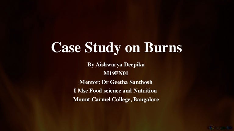 Case history of burn patient image