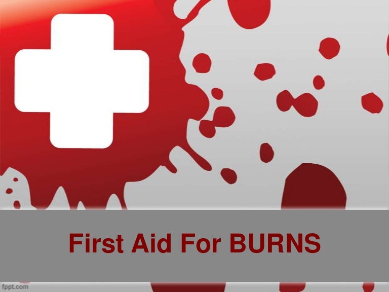 burns first aid burns first aid, Powerpoint templates