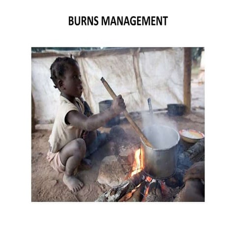 BURNS                   MANAGEMENT-1.ppt