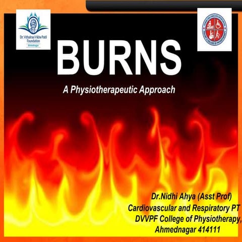 Burns management