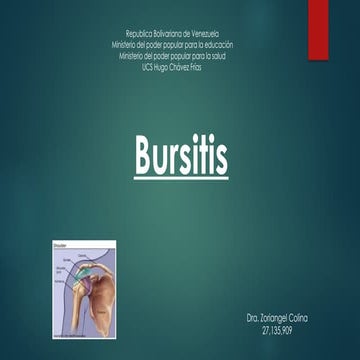 Bursitis | PPTX