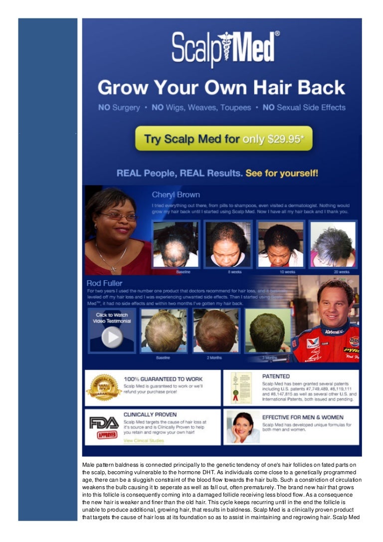 Buy Scalp Med Online and Regrow Your Hair