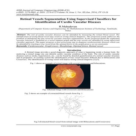 Retinal Vessels Segmentation Using Supervised Classifiers for Identification ...