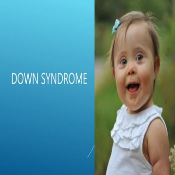Down Syndrome 1