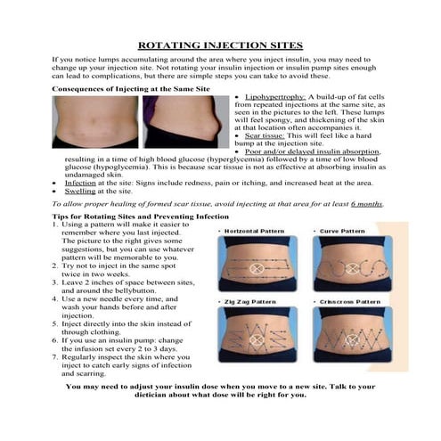ROTATING INJECTION SITES (1) | PDF