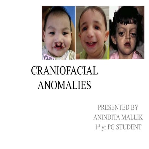 craniofacial anomalies
