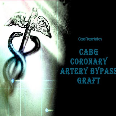 Cabg(final) | PPT