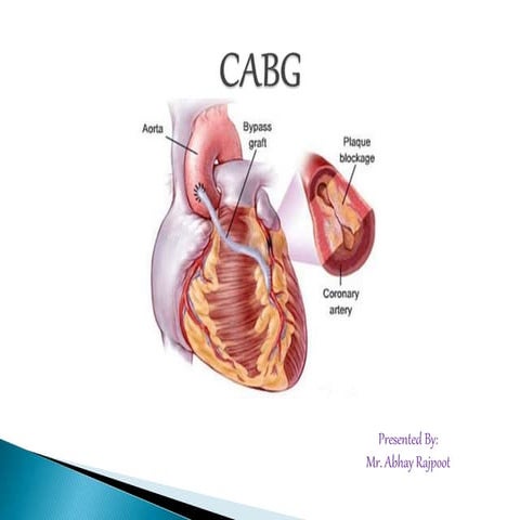 Heart lung machine and its components.pptx
