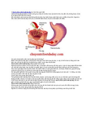 Một Số Cách Chữa Viêm Loét Dạ Dày Ngay Tại Nhà Đơn Giản Mà Hiệu Quả