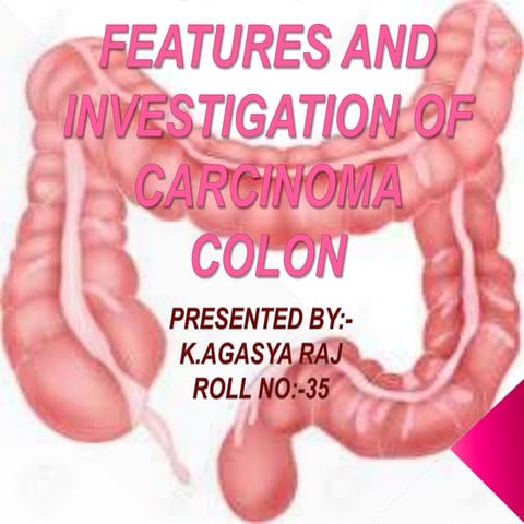 Carcinoma colon