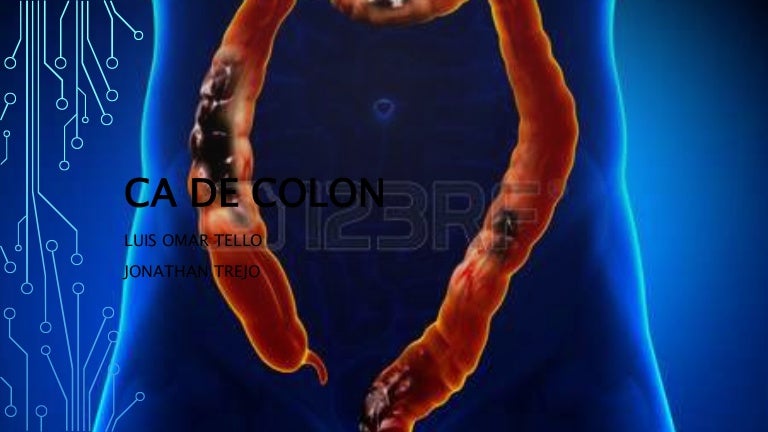 Ca colon Ca colon