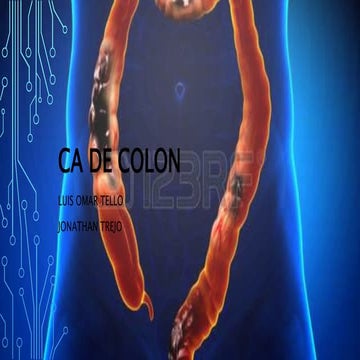 Ca colon | PPTX
