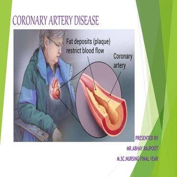 Coronary Artery Disease