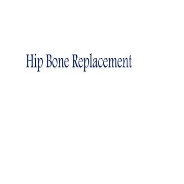Hip Bone replacement