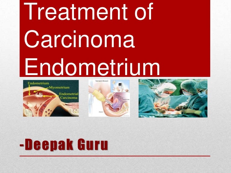treatment of Ca Endometrium