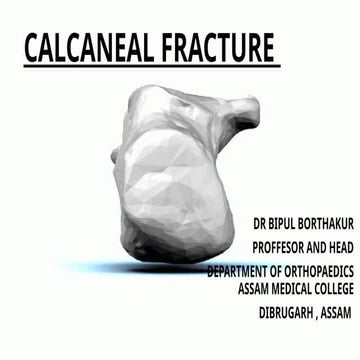 calcaneal fracture presentation pptx.ppt